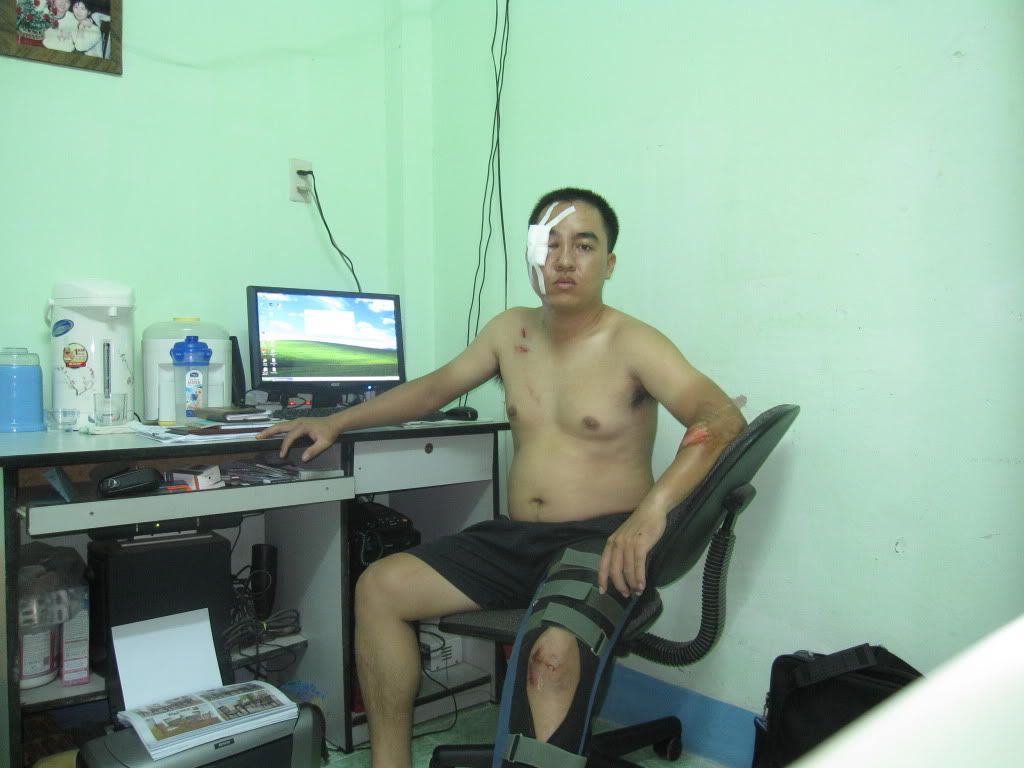 tai nạn thảm khốc, nhưng vẫn may mắn. - 1