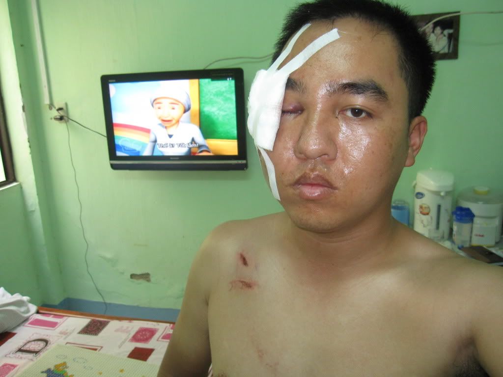 tai nạn thảm khốc, nhưng vẫn may mắn. - 2