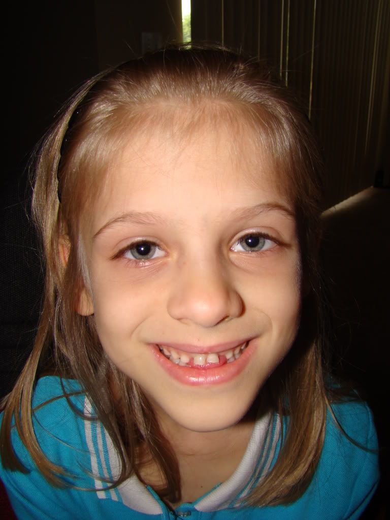 Larissa - Before she lost her tooth