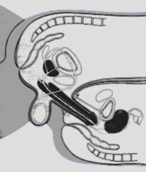 Coitus; Sexual Intercourse Coitus; Sexual Intercourse